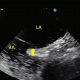 TEE with Bubble Study: Diagnosis + Heart Health | Study Travel Abroad | Explore Educational Trips & Global Learning Opportunities
