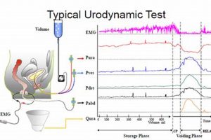 What is Urodynamics Study Testing? + Benefits Safem Fabrication - Precision Engineering & Custom Manufacturing Solutions What is Urodynamics Study Testing? + Benefits | Safem Fabrication - Precision Engineering & Custom Manufacturing Solutions