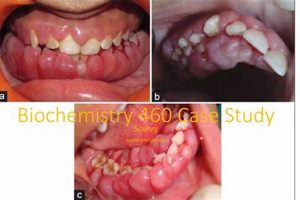 Scurvy Case: Ace Your Case Study Question Tips Study Travel Abroad | Explore Educational Trips & Global Learning Opportunities Scurvy Case: Ace Your Case Study Question Tips | Study Travel Abroad | Explore Educational Trips & Global Learning Opportunities