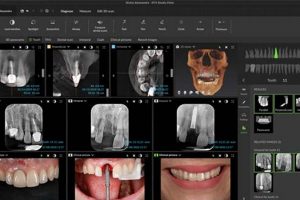 Discover dtx studio go: Dental Workflow on the Go! Study Travel Abroad | Explore Educational Trips & Global Learning Opportunities Discover dtx studio go: Dental Workflow on the Go! | Study Travel Abroad | Explore Educational Trips & Global Learning Opportunities