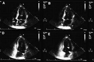 Understanding Bubble Study TTE: A Guide for the Study Niche | Study Travel Abroad | Explore Educational Trips & Global Learning Opportunities
