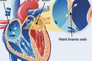 Unlock Heart Health: TEE with Bubble Study Explained | Study Travel Abroad | Explore Educational Trips & Global Learning Opportunities
