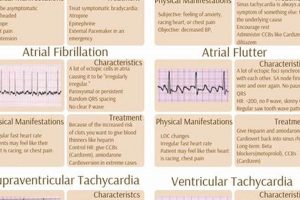 Best EKG Study Guide: Your EKG Exam Guide | Study Travel Abroad | Explore Educational Trips & Global Learning Opportunities