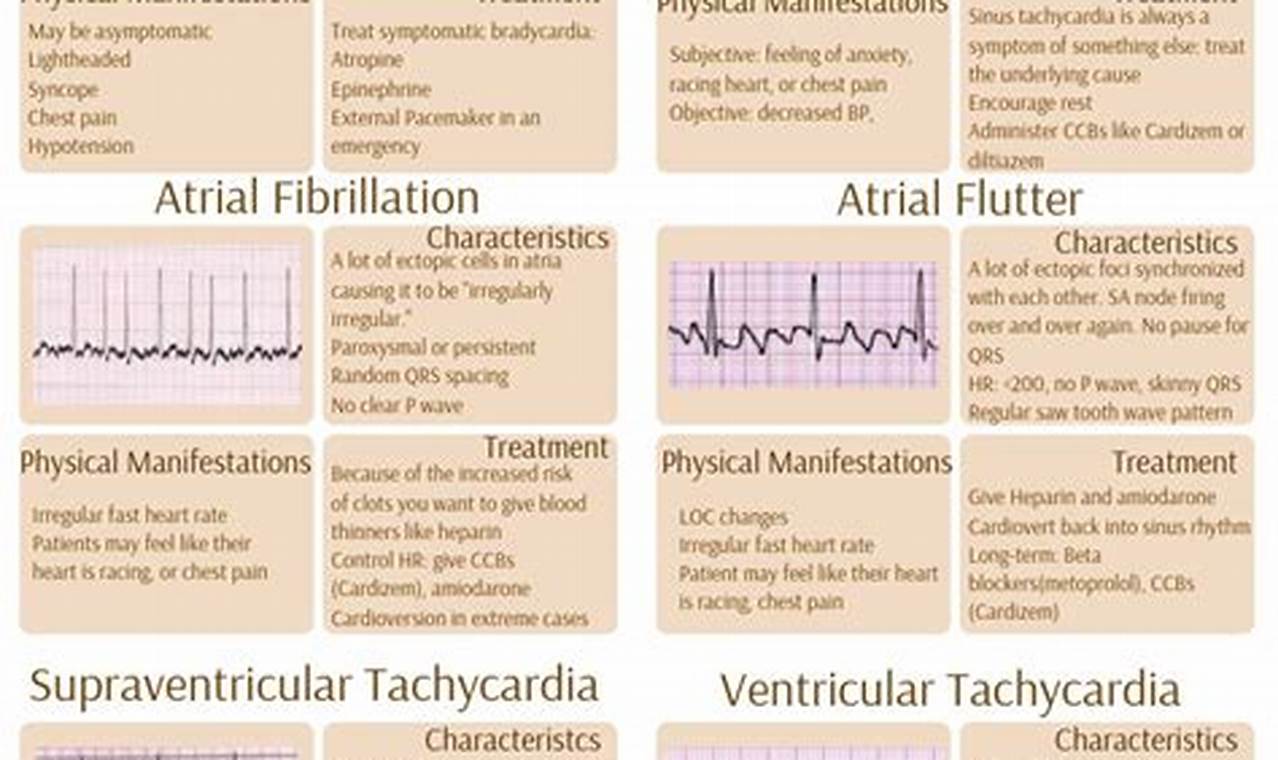 Best EKG Study Guide: Your EKG Exam Guide | Study Travel Abroad | Explore Educational Trips & Global Learning Opportunities