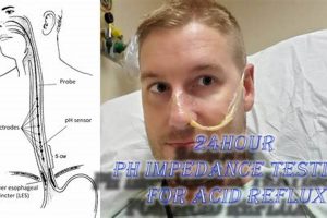 Is a pH Impedance Study Right For You? Study Travel Abroad | Explore Educational Trips & Global Learning Opportunities Is a pH Impedance Study Right For You? | Study Travel Abroad | Explore Educational Trips & Global Learning Opportunities